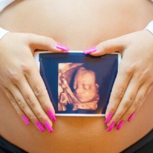 Imagem relativa a ultrassonografia